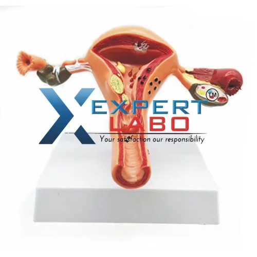 PVC Female Reproductive Organs Model