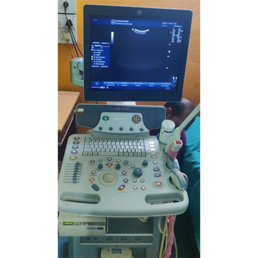 Used Ultrasound Machine - Accuracy: 100 %