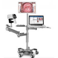 Digital Video Colposcope - Attributes: High Quality