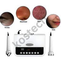 Mini Ultrasonic Spot Removal 3 in 1