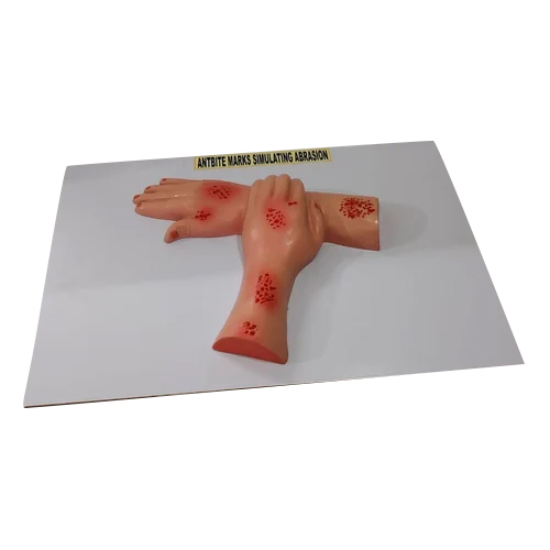 Antibite Marks Simulating Abrasion
