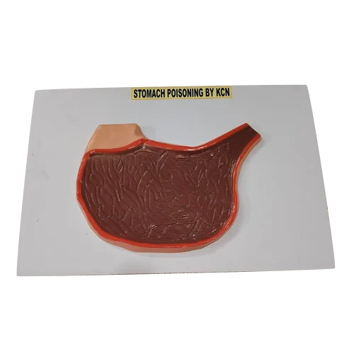 Stomach Poisoning Model