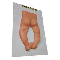 Plastic Ricket Disease - Color: Natural