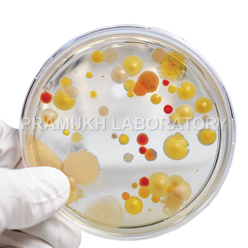Listeria Monocytogens Testing Services