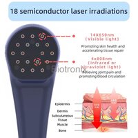 Handheld Physiotherapy Laser Therapy