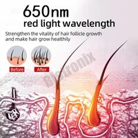 Advanced Laser Proctology Machine 980nm & 1470nm Diode Laser for Fissure & Hemorrhoids