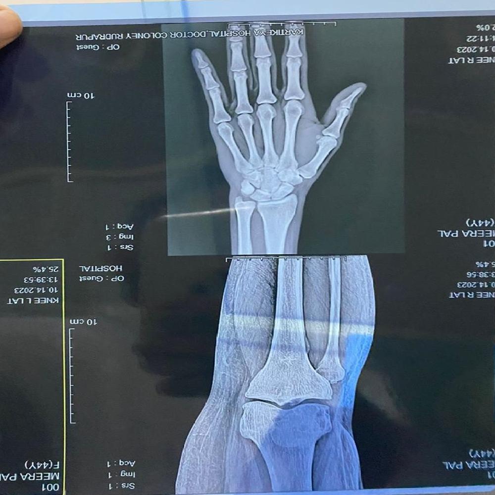 X-RAY FILMS 