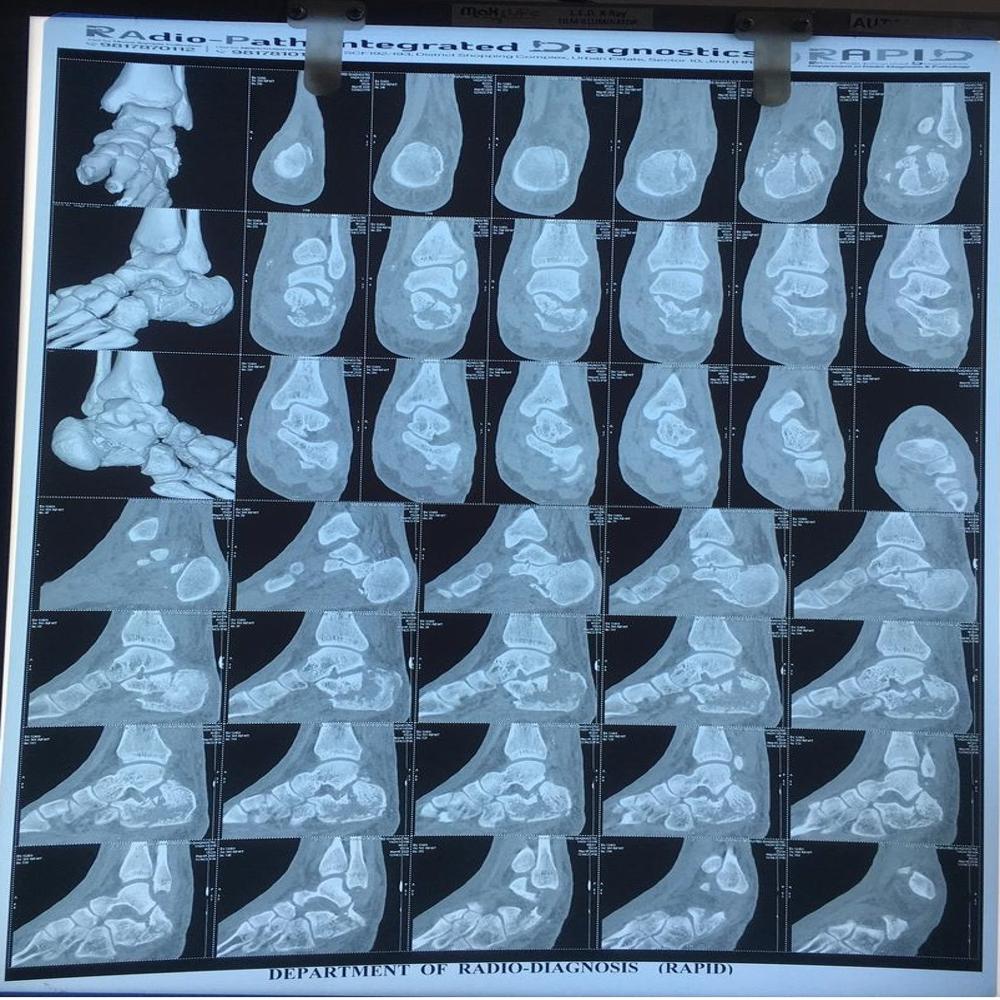 X-RAY FILMS 