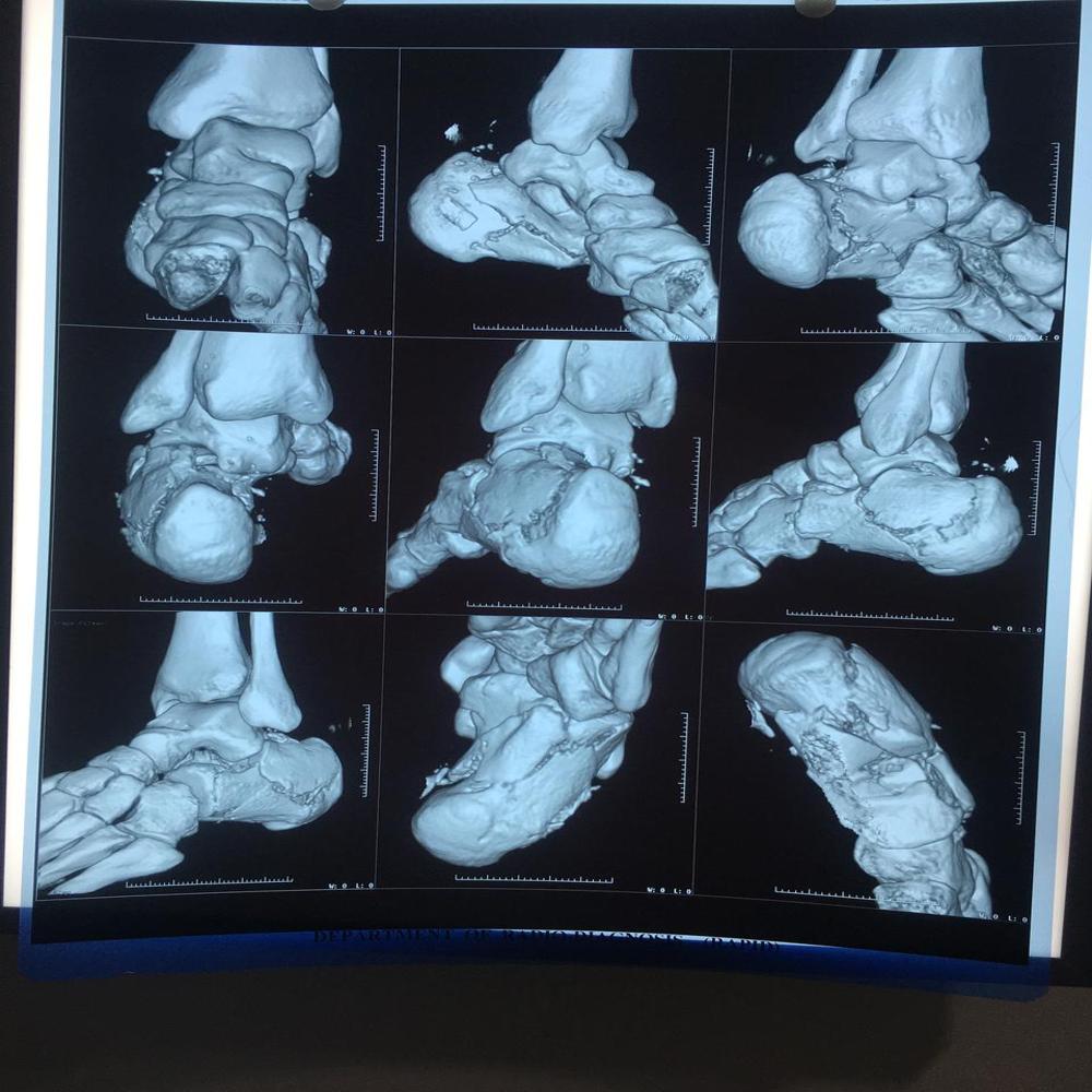 X-RAY FILMS 