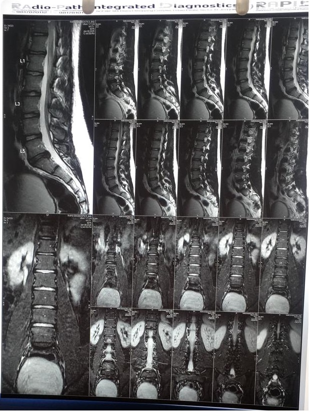 X-RAY FILMS 