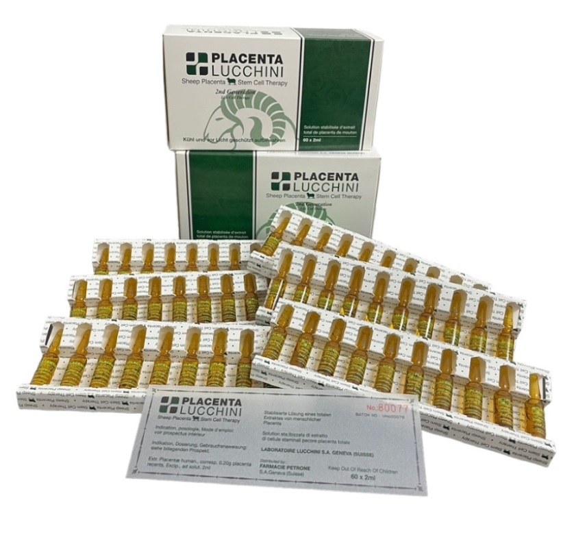 लुक्चीनी शीप प्लेसेंटा स्टेम सेल थेरेपी 2रे जनरेशन