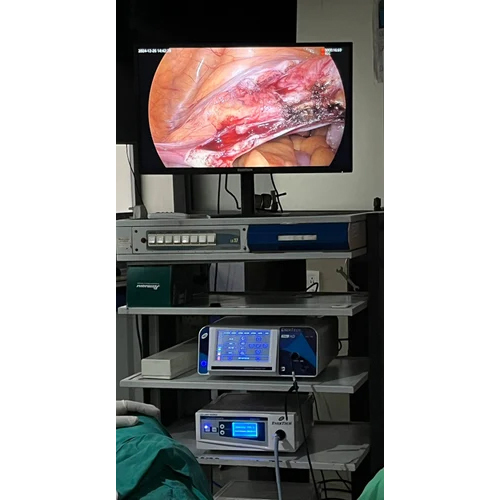 Enertech Complete Laparoscopy System