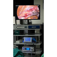 Enertech Complete Laparoscopy System - Feature: Easy To Install