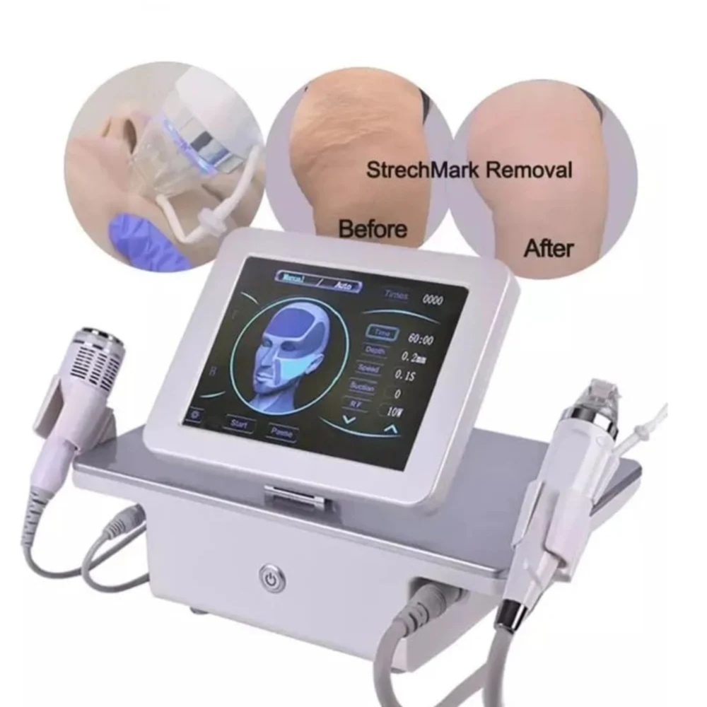 Microneedling Radio Frequency Machine (Mn Rf), 1.6 Mm