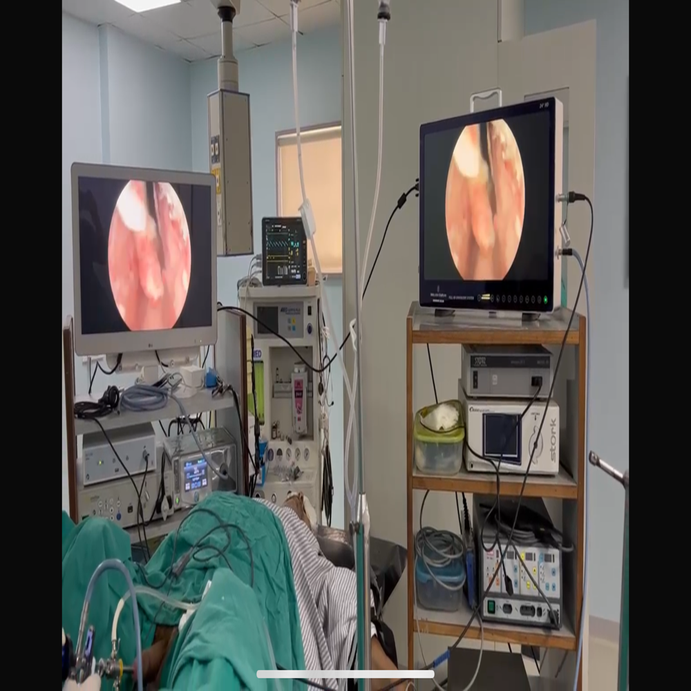 Surgical Camera