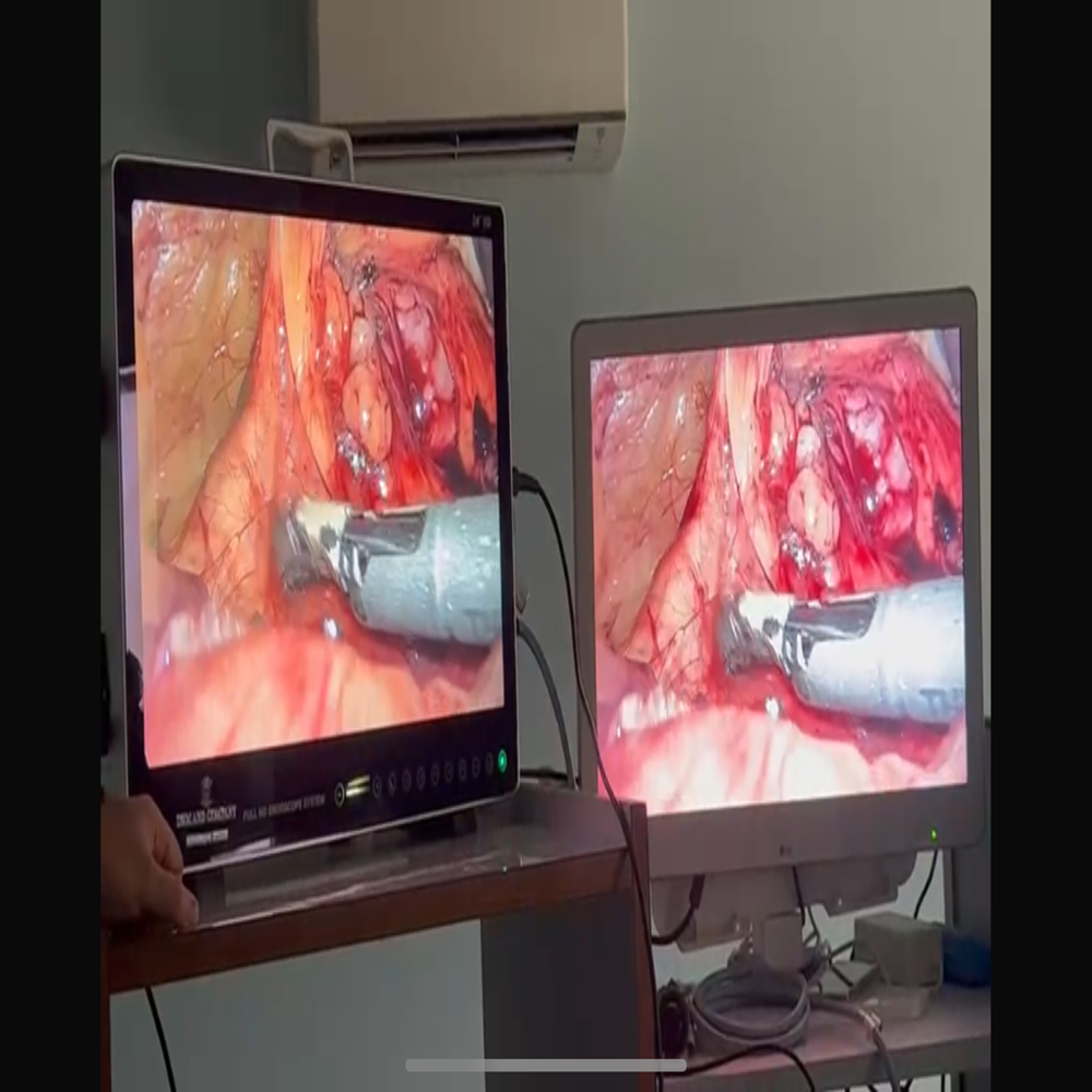 Urology Camera Portable Integrated - Application: Medical Screening