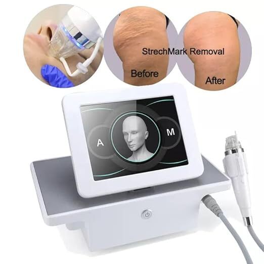 Microneedling Radio Frequency Machine (Mn Rf) 1.6 Mm