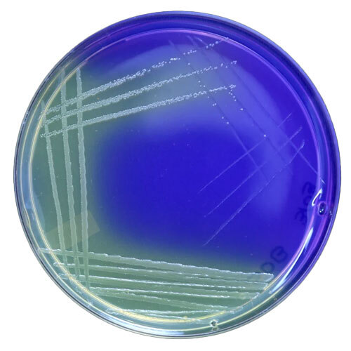 Sulphur Oxidizing Bacteria