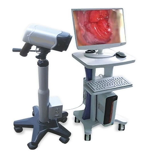 Auto Focusing Digital Video Colposcope