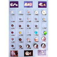 Mop Button