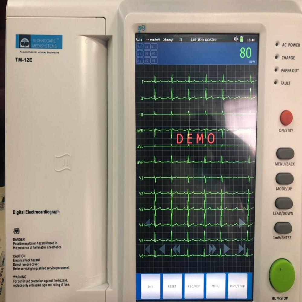 Digital Ecg Machine