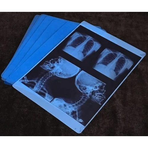 Inkjet X Ray Film - Color: White