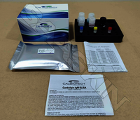 Calbiotech Cardiolipin IgM ELISA