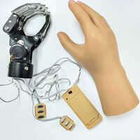 Myoelectric Functional Hand