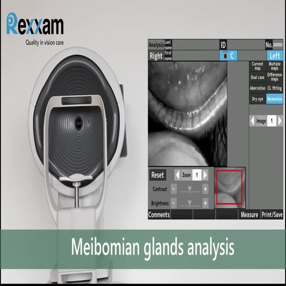 Rexxam Ret 700 Corneal Topography System Magnification: High