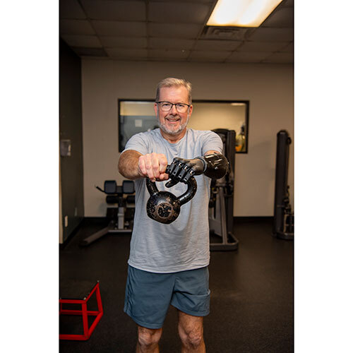 Artificial Hand Prosthesis