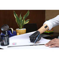 Artificial Hand Prosthesis