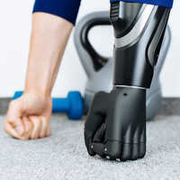 Prosthetic Arm
