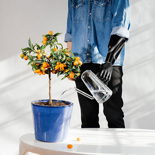 Prosthetic Hand