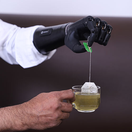 Zeus - Locally Repairable Prosthetic Hand - Application: Hospital