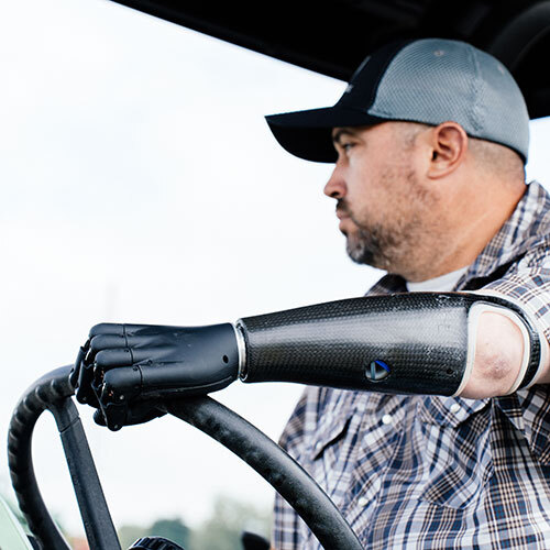 Zeus - Locally repairable Prosthetic Hand