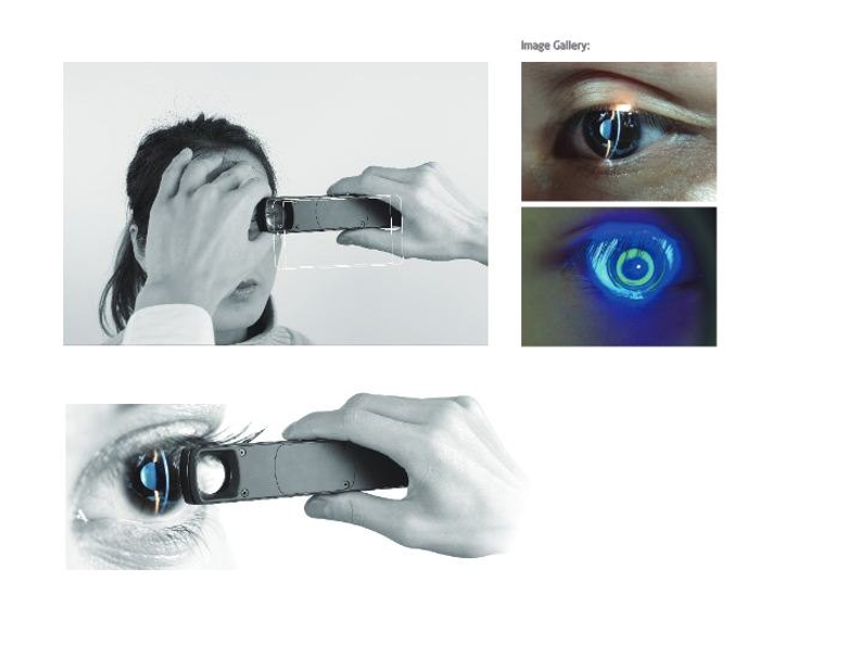MediWorks S150 Portable Slit Lamp