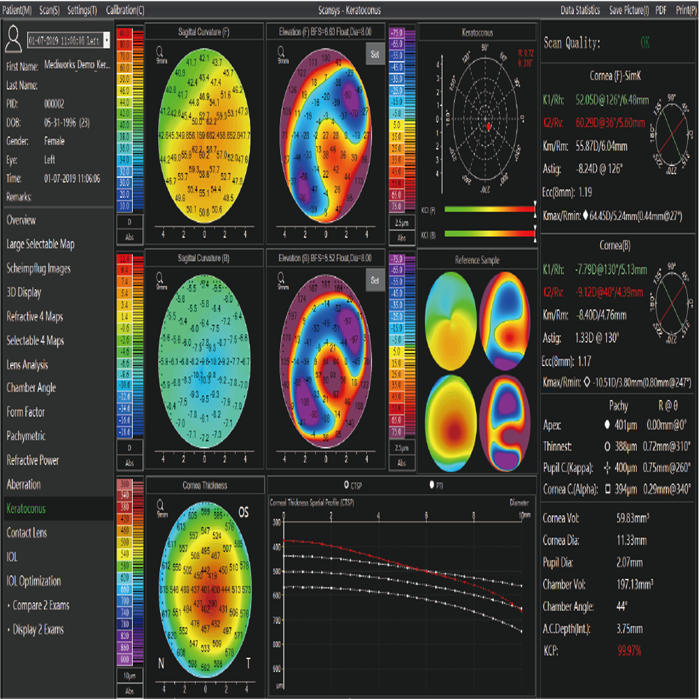 Scansys TA 517 Anterior Segment Analyzer