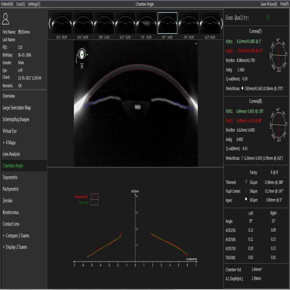 Scansys TA 517 Anterior Segment Analyzer