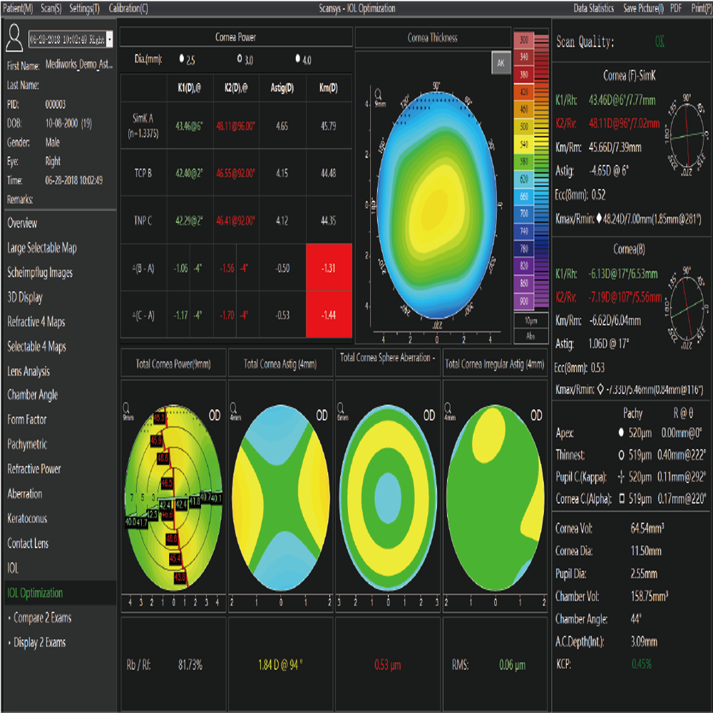 Scansys TA 517 Anterior Segment Analyzer