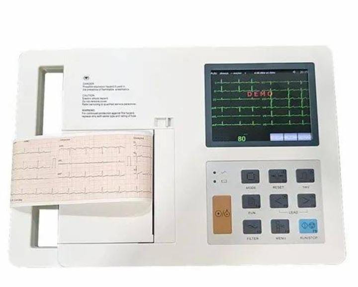 Thermal printer ECG Rechargeable ECG ECG data storage ECG analysis software EMR/EHR integration