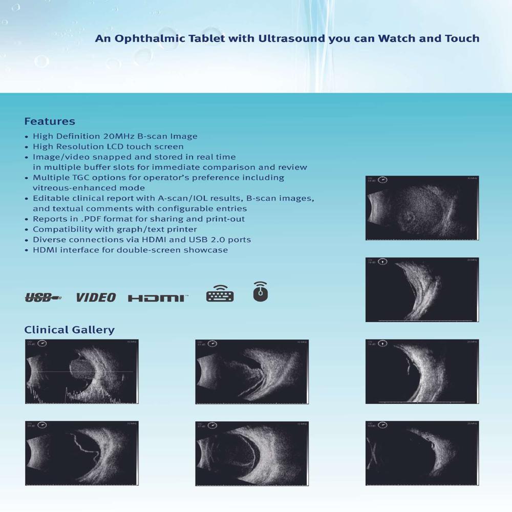 Eyevis Ultrasonic A/B Scanner EAB 1