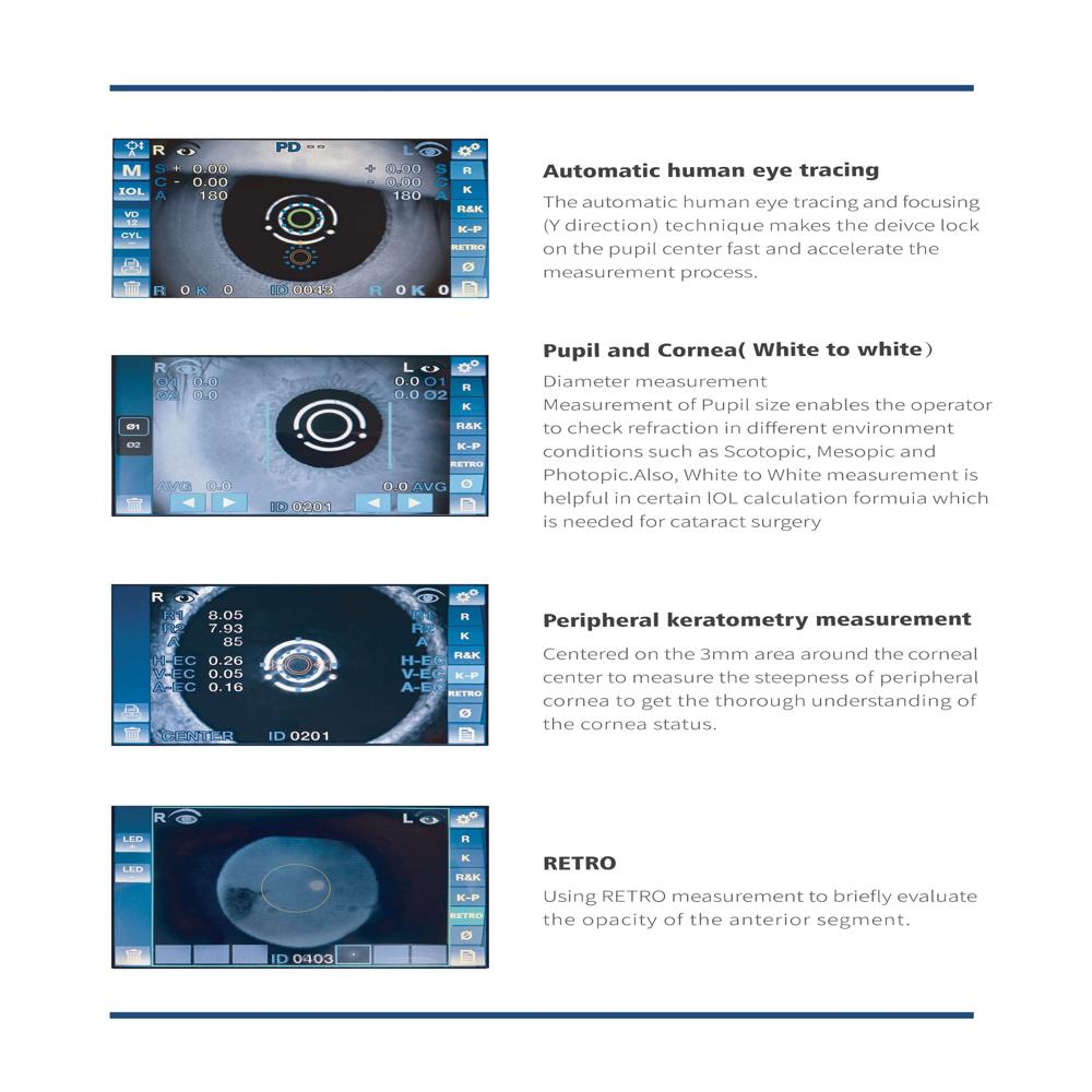 Eyevis Autorefractometer Model Rm-9900 - Color: White