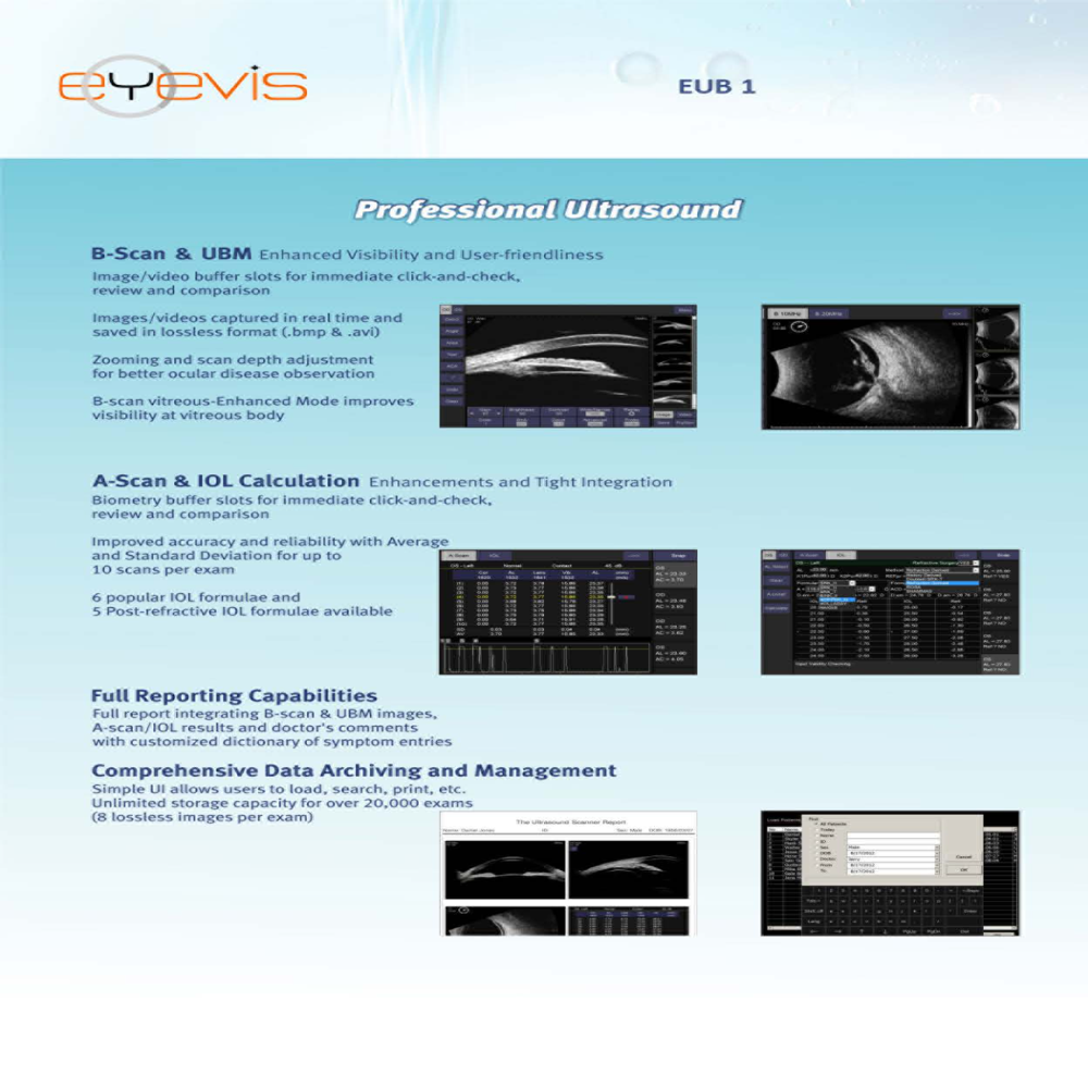 Eyevis EUB 1 Ultrasonic A/B Scanner for Ophthalmology with UBM