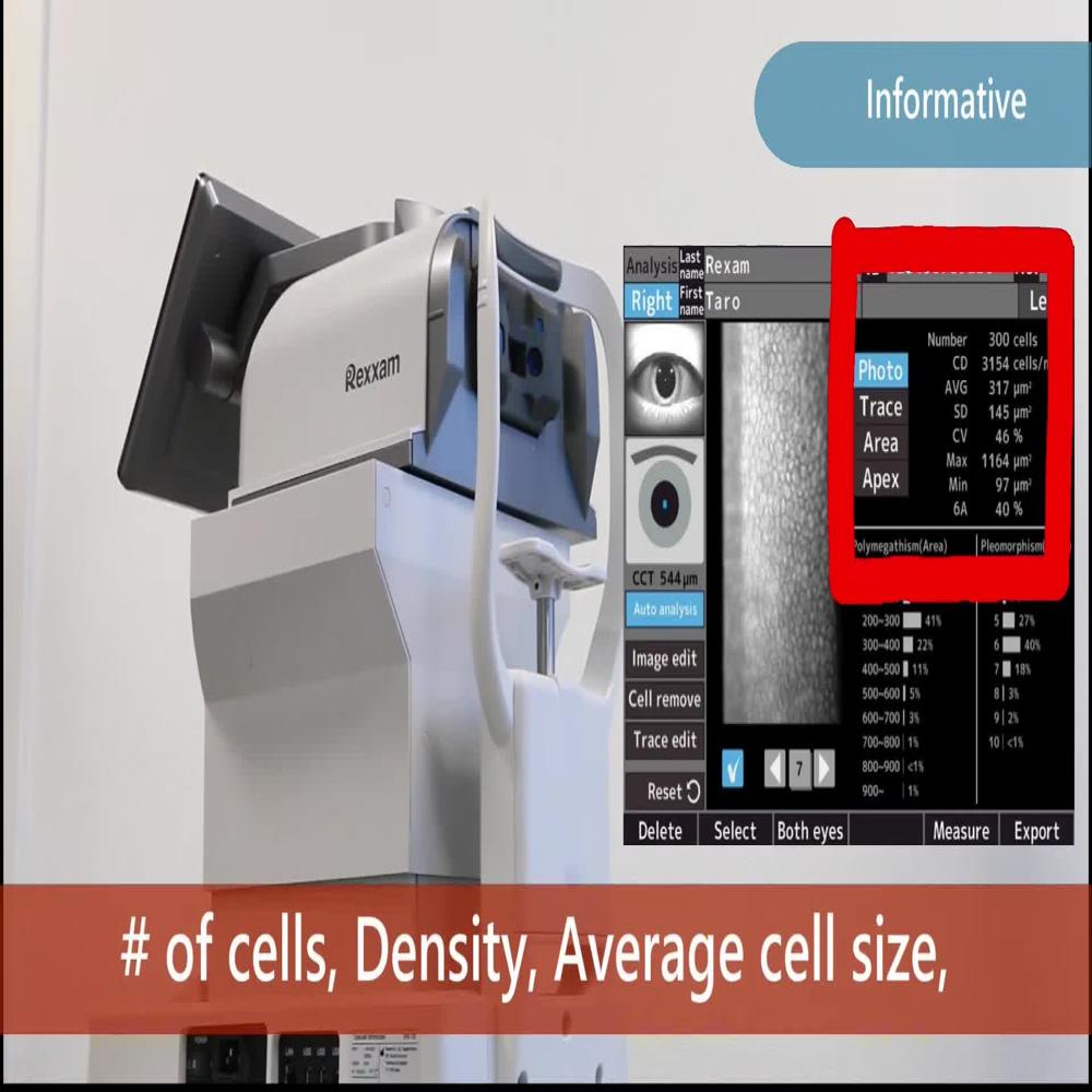 Rexxam Specular Microscope Spm 700 - Color: White