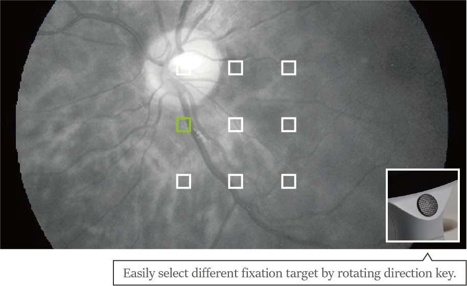 Mediworks Portable Fundus Camera Fc 161 - Color: Silver