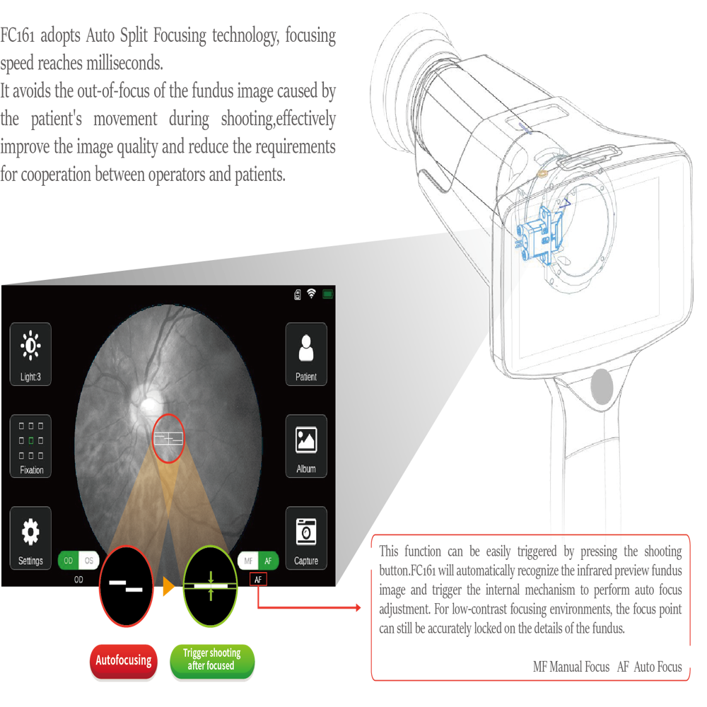 Mediworks Portable Fundus Camera Fc 161 - Color: Silver
