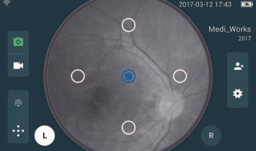 Mediworks Portable Fundus Camera Fc 161 - Color: Silver