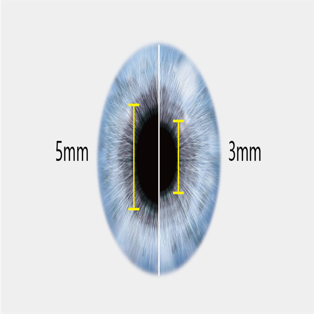 Mediworks Portable Fundus Camera FC 161