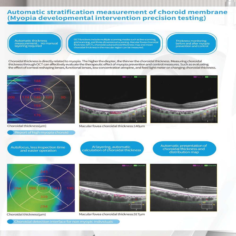 Eyevis Optical Coherence Tomography OCT