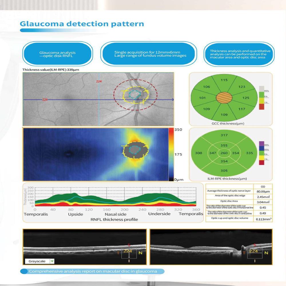 Eyevis Optical Coherence Tomography OCT